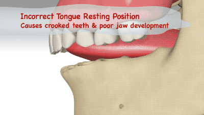 1573780833v2-56195b6c28940d4f369fe599774603ee_b.gif?size=440625